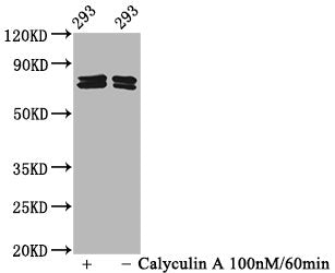 Phospho-PAK4/PAK5/PAK6 (S474/S560/S602) Recombinant Monoclonal Antibody