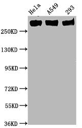 Phospho-POLR2A (S5) Recombinant Monoclonal Antibody