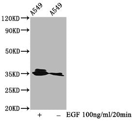 Phospho-PPP2CA (Y307) Recombinant Monoclonal Antibody
