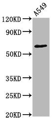 Phospho-PRKCZ (T560) Recombinant Monoclonal Antibody