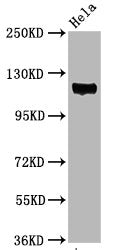 Phospho-PTK2 (Y397) Recombinant Monoclonal Antibody