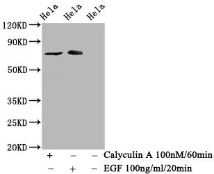 Phospho-RAF1 (S621) Recombinant Monoclonal Antibody
