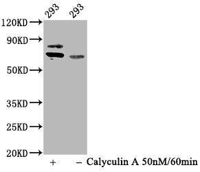 Phospho-RPS6KB1 (T421+S424) Recombinant Monoclonal Antibody