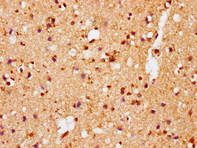 Phospho-SNCA (S129) Recombinant Monoclonal Antibody