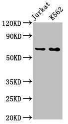 STIP1 Recombinant Monoclonal Antibody