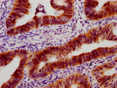 Phospho-TP53 (S33) Recombinant Monoclonal Antibody