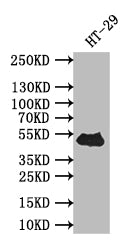 TP53 Recombinant Monoclonal Antibody