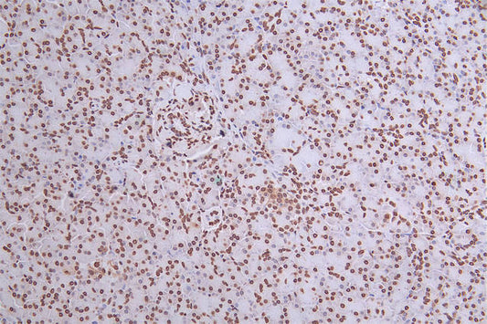 H2AFX Recombinant Monoclonal Antibody