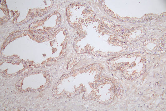 CLDN5 Recombinant Monoclonal Antibody