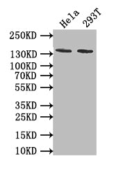 PKN2 Recombinant Monoclonal Antibody