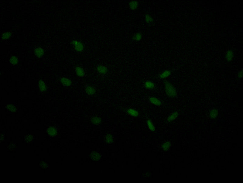 USP22 Recombinant Monoclonal Antibody