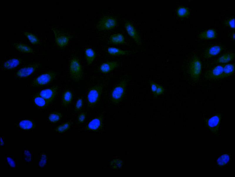 PITX3 Recombinant Monoclonal Antibody