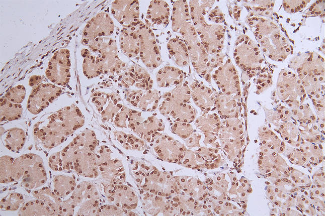 HIST1H1C Recombinant Monoclonal Antibody