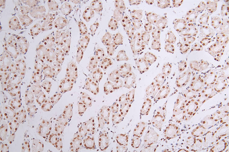 SMARCA4 Recombinant Monoclonal Antibody