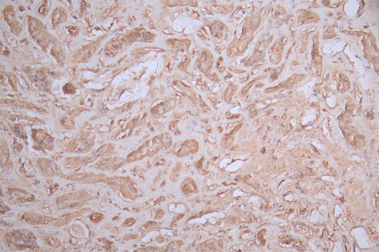 ASS1 Recombinant Monoclonal Antibody