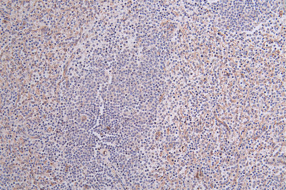 CD36 Recombinant Monoclonal Antibody