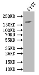 NCAM Recombinant Monoclonal Antibody