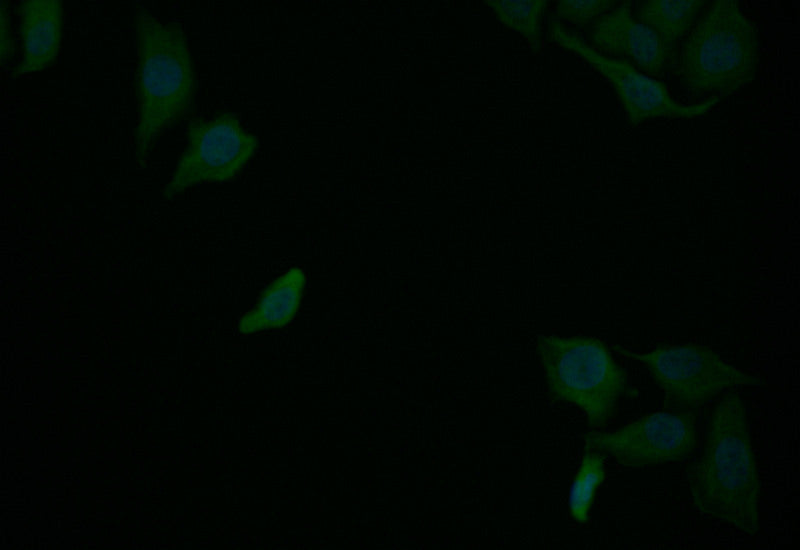 RELB Recombinant Monoclonal Antibody