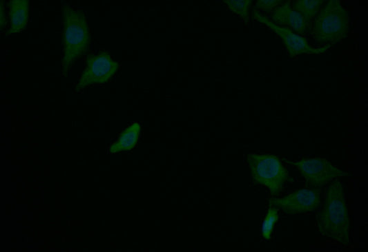 RELB Recombinant Monoclonal Antibody