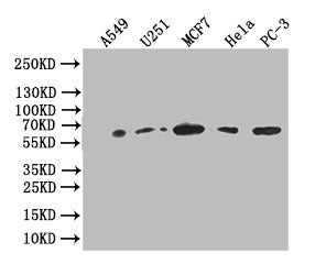 GPI Recombinant Monoclonal Antibody