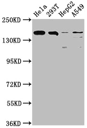 BRD4 Recombinant Monoclonal Antibody