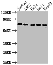 FUBP1 Recombinant Monoclonal Antibody
