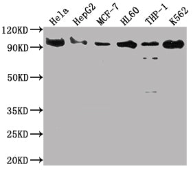 SUZ12 Recombinant Monoclonal Antibody