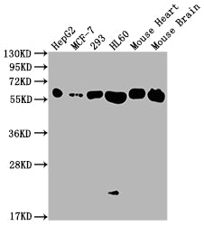 ATP5A1 Recombinant Monoclonal Antibody