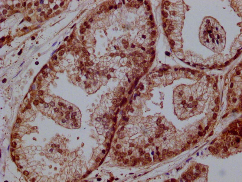 PRKAG1 Recombinant Monoclonal Antibody