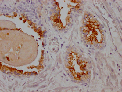 FOLH1 Recombinant Monoclonal Antibody
