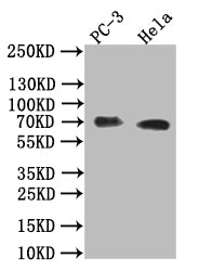 ALPP Recombinant Monoclonal Antibody