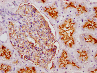 MME Recombinant Monoclonal Antibody