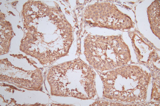 RAN Recombinant Monoclonal Antibody