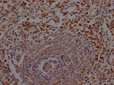 ELANE Recombinant Monoclonal Antibody