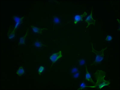 AURKA Recombinant Monoclonal Antibody