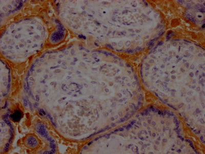 HP Recombinant Monoclonal Antibody