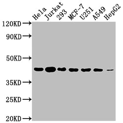 AURKB Recombinant Monoclonal Antibody