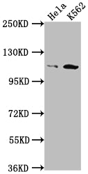 PIK3CB Recombinant Monoclonal Antibody