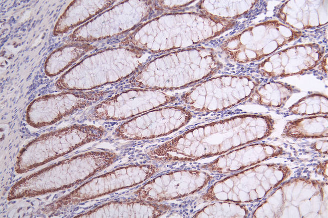 SATB2 Recombinant Monoclonal Antibody