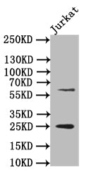 EBI3 Recombinant Monoclonal Antibody