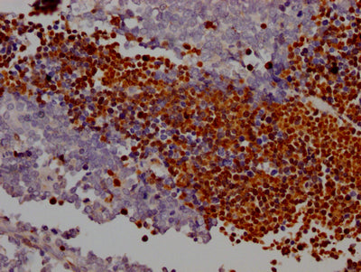 PARP1 Recombinant Monoclonal Antibody