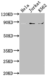 IKBKB Recombinant Monoclonal Antibody