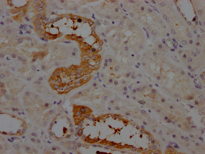 AGT Recombinant Monoclonal Antibody