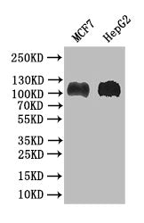 BRIP1 Recombinant Monoclonal Antibody