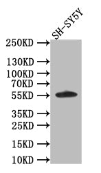 AKT1/2/3 Recombinant Monoclonal Antibody