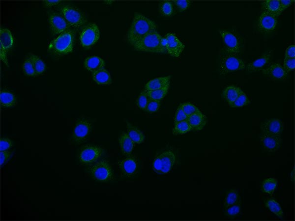 RAB25 Recombinant Monoclonal Antibody
