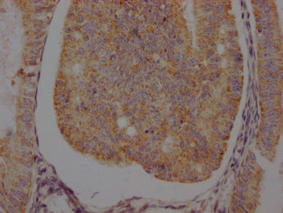 ADRB2 Recombinant Monoclonal Antibody