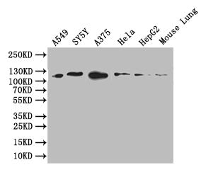 DDR2 Recombinant Monoclonal Antibody