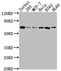 PTPN11 Recombinant Monoclonal Antibody