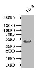 DDB2 Recombinant Monoclonal Antibody